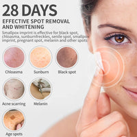 Dimollaure Whitening Freckle Cream Remove Melasma Acne Spot Pigment Dark Spots Melanin Age Spots Moisturizing Brighten Skin Care