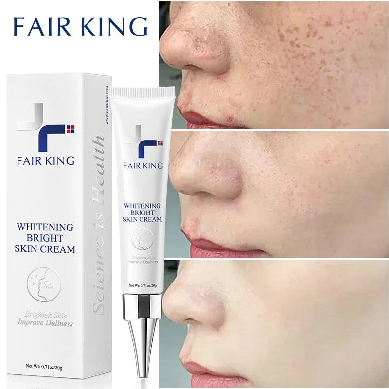 Dark Spot Corrector Skin Whitening Fade Cream Lightening Blemish Removal Serum Reduces Age Spots Freckles Face Cream 20g