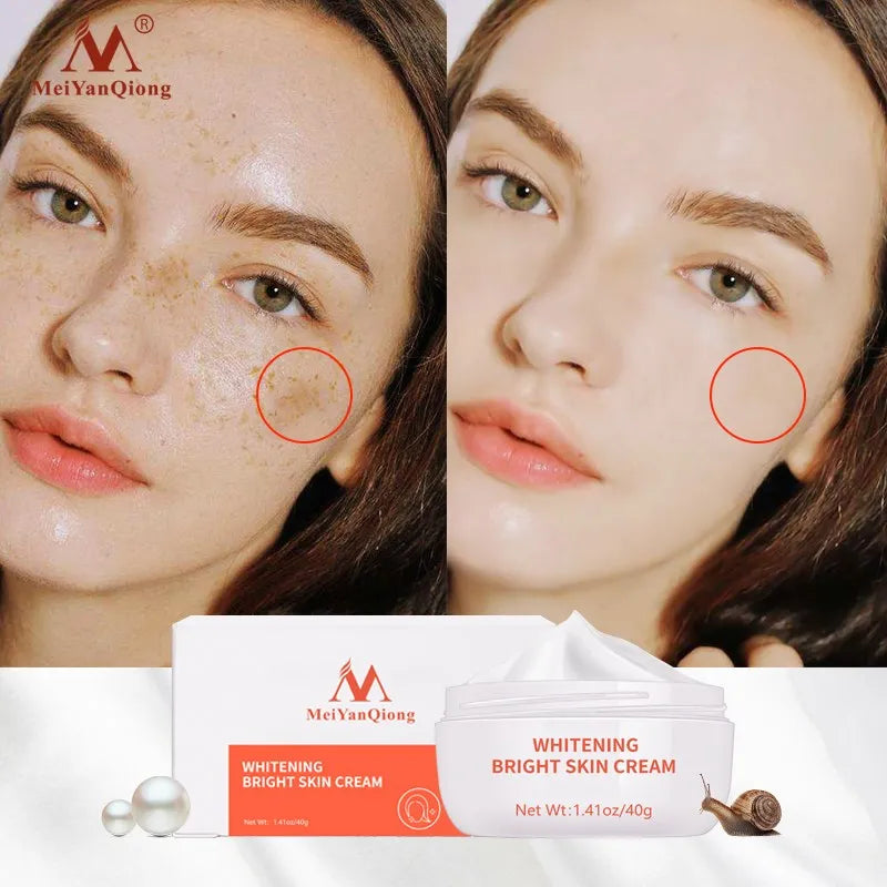 Dark Spot Remover Cream Skin Lightening Cream Dark Skin Care Anti Freckle  Whitening Cream  Anti Aging Face Care