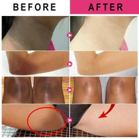 Body Whitening Cream Intimate Areas Underarm Bleach Knee Legs Buttocks Private Parts Remove Melanin Brighten Cream for Dark Skin